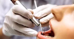 Rehabilitación Dental