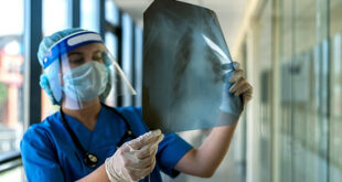 Tuberculosis
