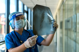 Tuberculosis