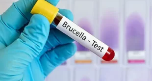 Brucelosis, una zoonosis prevenible