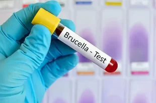 Brucelosis, una zoonosis prevenible