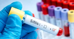 Sífilis en aumento