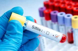 Sífilis en aumento