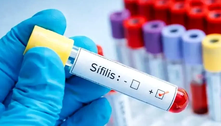 Sífilis en aumento