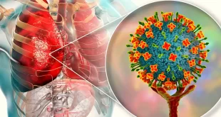 Alerta por brote de virus Nipah