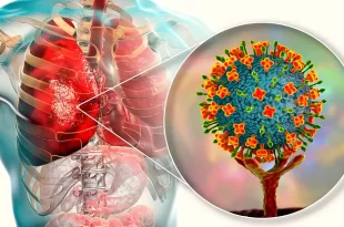 Alerta por brote de virus Nipah