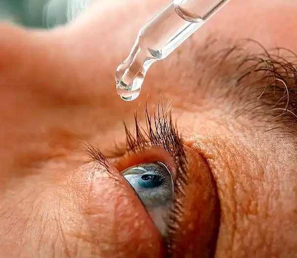 Glaucoma: la enfermedad silenciosa