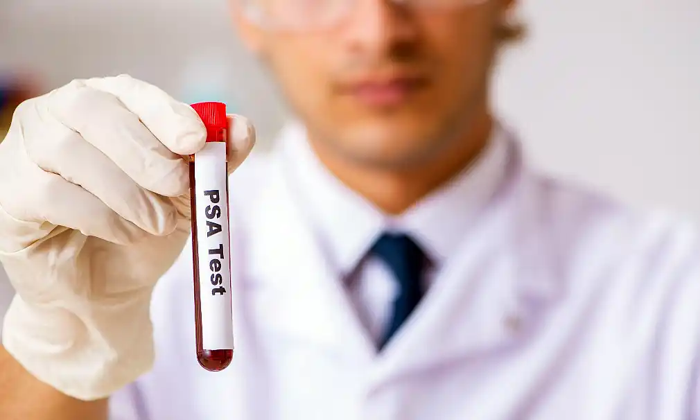 Controles gratuitos de cáncer de próstata durante todo agosto 1 Controles gratuitos de cáncer de próstata